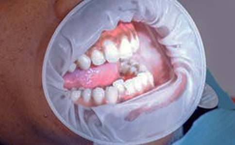 ר��֧�н������������Ѫ